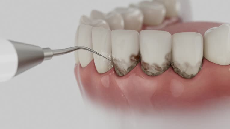 Reliable Dental Implants contractor in Hicksville, NY by Smile Center Dentistry